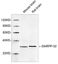 PPP1R1B / DARPP-32 Antibody - Western blot of tissue lysates using 1 ug/ml DARPP-32 Antibody, pAb, Rabbit. The signal was developed with IRDye 800 Conjugated Goat Anti-Rabbit IgG. Predicted Size: 32 KD. Observed Size: 32 KD.