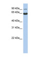 PPP1R21 / KLRAQ1 Antibody - KLRAQ1 antibody Western blot of Fetal Muscle lysate. This image was taken for the unconjugated form of this product. Other forms have not been tested.