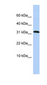 PPP1R27 / DYSFIP1 Antibody - DYSFIP1 antibody Western blot of HepG2 cell lysate. This image was taken for the unconjugated form of this product. Other forms have not been tested.
