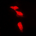 PPP2R5A Antibody - Immunofluorescent analysis of PPP2R5A staining in NIH3T3 cells. Formalin-fixed cells were permeabilized with 0.1% Triton X-100 in TBS for 5-10 minutes and blocked with 3% BSA-PBS for 30 minutes at room temperature. Cells were probed with the primary antibody in 3% BSA-PBS and incubated overnight at 4 C in a humidified chamber. Cells were washed with PBST and incubated with a DyLight 594-conjugated secondary antibody (red) in PBS at room temperature in the dark. DAPI was used to stain the cell nuclei (blue).