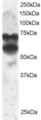 PPP2R5D Antibody - Antibody staining (2 ug/ml) of 293 lysate (RIPA buffer, 30 ug total protein per lane). Primary incubated for 1 hour. Detected by Western blot of chemiluminescence.