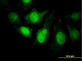 PPP3R1 / Calcineurin B Antibody - Immunofluorescence of monoclonal antibody to PPP3R1 on HeLa cell. [antibody concentration 25 ug/ml]