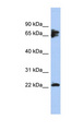 PPP3R1 / Calcineurin B Antibody - PPP3R1 antibody Western blot of NCI-H226 cell lysate. This image was taken for the unconjugated form of this product. Other forms have not been tested.