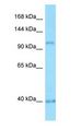 PPP4R1 / PP4R1 Antibody - PPP4R1 / PP4R1 antibody Western Blot of HT1080 cell lysate.  This image was taken for the unconjugated form of this product. Other forms have not been tested.