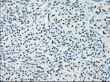 PPP5C Antibody - Immunohistochemical staining of paraffin-embedded Human endometrium tissue using anti-PPP5C mouse monoclonal antibody.