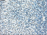 PPP5C Antibody - Immunohistochemical staining of paraffin-embedded endometrium tissue using anti-PPP5C mouse monoclonal antibody. (Dilution 1:50).
