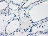PPP5C Antibody - IHC of paraffin-embedded thyroid tissue using anti-PPP5C mouse monoclonal antibody. (Dilution 1:50).