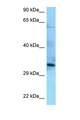 PPP6C Antibody - PPP6C antibody Western blot of HepG2 Cell lysate. Antibody concentration 1 ug/ml.  This image was taken for the unconjugated form of this product. Other forms have not been tested.