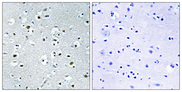 PPRC1 Antibody - Immunohistochemistry analysis of paraffin-embedded human brain tissue, using PPRC1 Antibody. The picture on the right is blocked with the synthesized peptide.