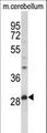 PPT1 / CLN1 Antibody - Western blot of hPPT1-C46 in mouse cerebellum tissue lysates (35 ug/lane). PPT1 (arrow) was detected using the purified antibody.