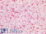 PPT1 / CLN1 Antibody - Human Liver Lysosomal Staining: Formalin-Fixed, Paraffin-Embedded (FFPE)