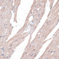 PPT2 Antibody - Immunohistochemistry of paraffin-embedded mouse heart using PPT2 antibody at dilution of 1:100 (40x lens).