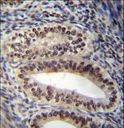 PR / Progesterone Receptor Antibody - PGR/PR Antibody immunohistochemistry of formalin-fixed and paraffin-embedded human uterus tissue followed by peroxidase-conjugated secondary antibody and DAB staining.