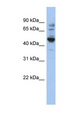 PRAME Antibody - PRAME antibody Western blot of HepG2 cell lysate. This image was taken for the unconjugated form of this product. Other forms have not been tested.
