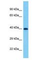 PRAMEF19 Antibody - PRAMEF19 antibody Western Blot of 721_B. Antibody dilution: 1 ug/ml.  This image was taken for the unconjugated form of this product. Other forms have not been tested.