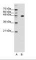 PRDM12 Antibody - A: Marker, B: HepG2 Cell Lysate.  This image was taken for the unconjugated form of this product. Other forms have not been tested.