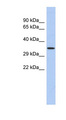 PRDM12 Antibody - PRDM12 antibody Western blot of Fetal Thymus lysate. This image was taken for the unconjugated form of this product. Other forms have not been tested.