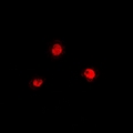 PRDM7 Antibody - Immunofluorescent analysis of PRDM7 staining in A549 cells. Formalin-fixed cells were permeabilized with 0.1% Triton X-100 in TBS for 5-10 minutes and blocked with 3% BSA-PBS for 30 minutes at room temperature. Cells were probed with the primary antibody in 3% BSA-PBS and incubated overnight at 4 deg C in a humidified chamber. Cells were washed with PBST and incubated with a DyLight 594-conjugated secondary antibody (red) in PBS at room temperature in the dark.
