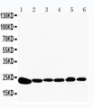 PRDX2 / Peroxiredoxin 2 Antibody - WB of PRDX2 / Peroxiredoxin 2 antibody. All lanes: Anti-PRDX2 at 0.5ug/ml. Lane 1: Rat Brain Tissue Lysate at 40ug. Lane 2: Rat Kidney Tissue Lysate at 40ug. Lane 3: HELA Whole Cell Lysate at 40ug. Lane 4: JURKAT Whole Cell Lysate at 40ug. Lane 5: 293T Whole Cell Lysate at 40ug. Lane 6: A549 Whole Cell Lysate at 40ug. Predicted bind size: 22KD. Observed bind size: 22KD.