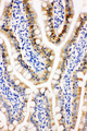 PRDX3 / Peroxiredoxin 3 Antibody - PRDX3 / Peroxiredoxin 3 antibody. IHC(P): Rat Intestine Tissue.