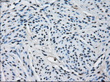 PRDX4 / Peroxiredoxin 4 Antibody - IHC of paraffin-embedded Human endometrium tissue using anti-PRDX4 mouse monoclonal antibody.