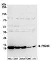 PRDX5 / Peroxiredoxin 5 Antibody - Detection of human and mouse PRDX5 by western blot. Samples: Whole cell lysate (50 µg) from HeLa, HEK293T, Jurkat, mouse TCMK-1, and mouse NIH 3T3 cells prepared using NETN lysis buffer. Antibody: Affinity purified rabbit anti-PRDX5 antibody used for WB at 0.1 µg/ml. Detection: Chemiluminescence with an exposure time of 30 seconds.