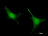 PREP / Prolyl Endopeptidase Antibody - Immunofluorescence of monoclonal antibody to PREP on HeLa cell . [antibody concentration 10 ug/ml]