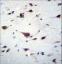 PREX1 / P-REX1 Antibody - PREX1 Antibody immunohistochemistry of formalin-fixed and paraffin-embedded human brain tissue followed by peroxidase-conjugated secondary antibody and DAB staining.