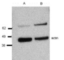 PRF1 / Perforin Antibody - Western Blot of human PBMC (Lane A) or PBMC stimulated with IL-2 for 3 days (Lane B) lysate; probed with 2 ug/mL purified antibody and anti-actin and revealed with HRP anti-rat IgG or anti-mouse IgG, respectively. Perforin is detected at ~65 kD and actin at ~42 kD. Actin was used a loading control to normalize the signal.