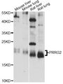 PRGP2 / PRRG2 Antibody - Western blot analysis of extracts of various cell lines, using PRRG2 antibody at 1:1000 dilution. The secondary antibody used was an HRP Goat Anti-Rabbit IgG (H+L) at 1:10000 dilution. Lysates were loaded 25ug per lane and 3% nonfat dry milk in TBST was used for blocking. An ECL Kit was used for detection and the exposure time was 15s.