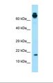 PRH2 Antibody - Western blot of Human Fetal Lung. PRH2 antibody dilution 1.0 ug/ml.  This image was taken for the unconjugated form of this product. Other forms have not been tested.