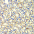 PRKAB2 / AMPK Beta 2 Antibody - Immunohistochemistry of paraffin-embedded rat kidney tissue.