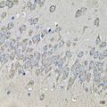 PRKAB2 / AMPK Beta 2 Antibody - Immunohistochemistry of paraffin-embedded mouse brain using PRKAB2 Antibody at dilution of 1:100 (40x lens).