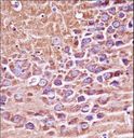 PRKACA + PRKACB Antibody - Mouse Prkaca/Prkacb Antibody immunohistochemistry of formalin-fixed and paraffin-embedded mouse brain tissue followed by peroxidase-conjugated secondary antibody and DAB staining.This data demonstrates the use of Mouse Prkaca/Prkacb Antibody for immunohistochemistry.
