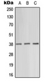 PRKAG1 / AMPK Gamma 1 Antibody - Western blot analysis of AMPK gamma 1 expression in HeLa (A); SP2/0 (B); H9C2 (C) whole cell lysates.