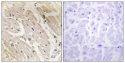 PRKAG2 / AMPK Gamma 2 Antibody - Immunohistochemistry analysis of paraffin-embedded human heart tissue, using PRKAG2 Antibody. The picture on the right is blocked with the synthesized peptide.