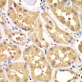 PRKAG3 / AMPK Gamma 3 Antibody - Immunohistochemistry of paraffin-embedded human kidney tissue.