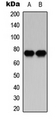 PRKCB / PKC-Beta Antibody - Western blot analysis of PKC beta expression in HeLa (A); Raw264.7 (B) whole cell lysates.