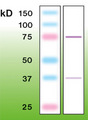 PRKCB / PKC-Beta Antibody - Western blot of PKC-betaII in mouse brain crude lysate (50 ug of protein loaded).