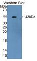 PRKCD / PKC-Delta Antibody
