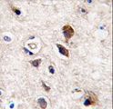 PRKCG / PKC-Gamma Antibody - Formalin-fixed and paraffin-embedded human brain tissue reacted with PKC gamma antibody , which was peroxidase-conjugated to the secondary antibody, followed by DAB staining. This data demonstrates the use of this antibody for immunohistochemistry; clinical relevance has not been evaluated.