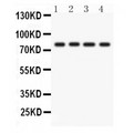 PRKCH / PKC-Eta Antibody - PKC eta antibody Western blot. All lanes: Anti PKC eta at 0.5 ug/ml. Lane 1: A431 Whole Cell Lysate at 40 ug. Lane 2: A549 Whole Cell Lysate at 40 ug. Lane 3: HELA Whole Cell Lysate at 40 ug. Lane 4: SKOV Whole Cell Lysate at 40 ug. Predicted band size: 78 kD. Observed band size: 78 kD.