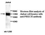 PRKCH / PKC-Eta Antibody