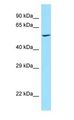 PRKCSH Antibody - PRKCSH antibody Western Blot of Human Kidney.  This image was taken for the unconjugated form of this product. Other forms have not been tested.