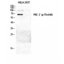 PRKCZ / PKC-Zeta Antibody - Western blot of Phospho-PKC zeta (T560) antibody