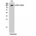 PRKD1 / PKC Mu Antibody - Western blot of Phospho-PKD1 (S205) antibody