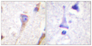 PRKD1 / PKC Mu Antibody - Immunohistochemistry analysis of paraffin-embedded human brain tissue, using PKD1/PKC mu Antibody. The picture on the right is blocked with the synthesized peptide.