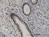 PRKRIP1 Antibody - Immunoperoxidase of monoclonal antibody to PRKRIP1 on formalin-fixed paraffin-embedded human endometrium. [antibody concentration 5 ug/ml]