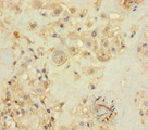 PRKRIR Antibody - Immunohistochemistry of paraffin-embedded human placenta tissue using THAP12 Antibody at dilution of 1:100