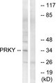 PRKY Antibody - Western blot analysis of lysates from Jurkat cells, using PRKY Antibody. The lane on the right is blocked with the synthesized peptide.